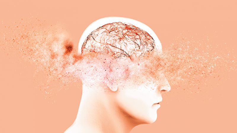 alzheimers